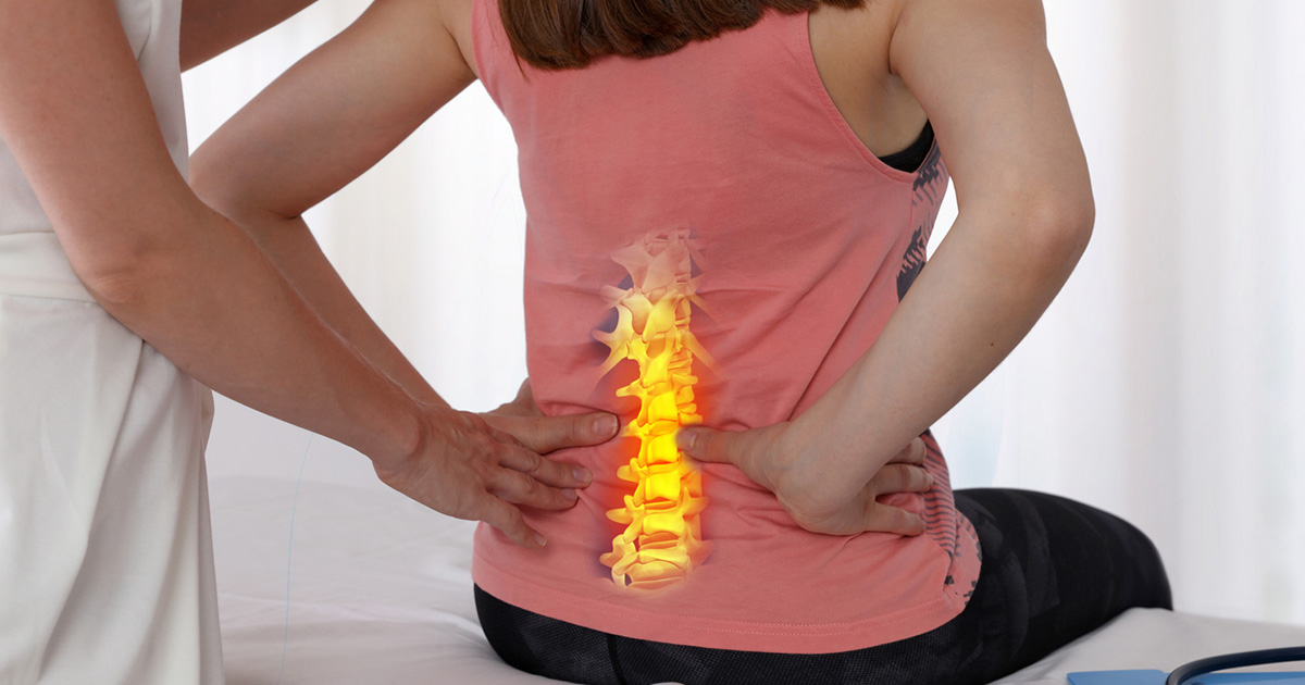 Sciatica: What It Actually Is, What Causes It, and What Resolves It